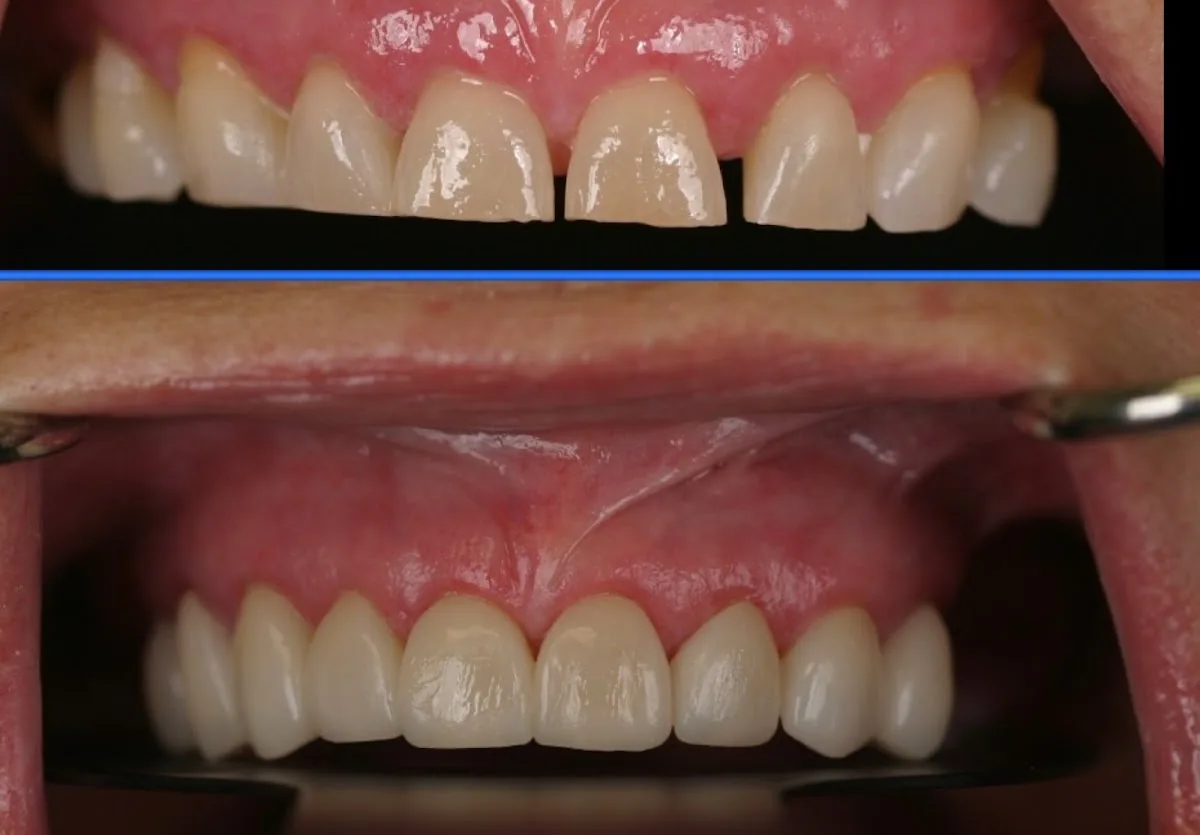 Great Smile Family Dentistry photo 4