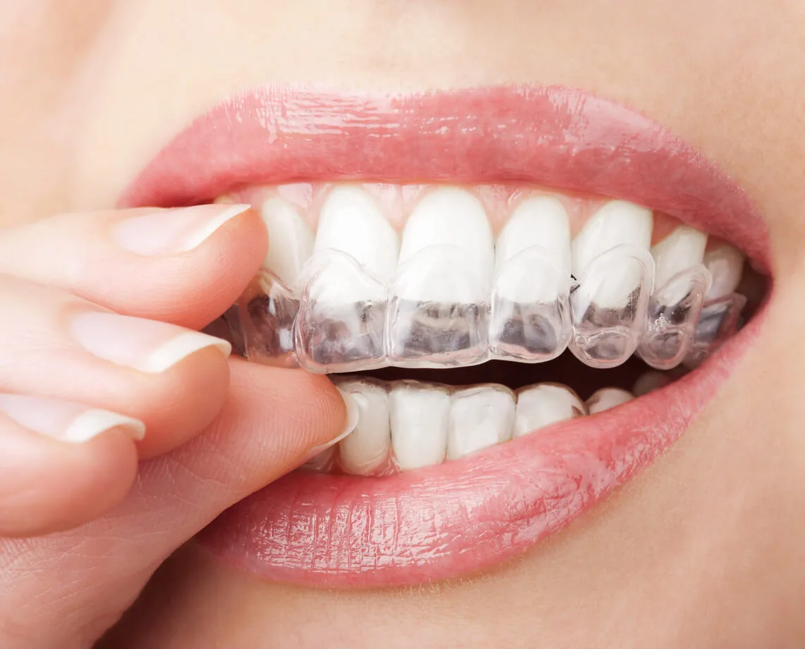 Cornerstone Dental Rochester photo 3