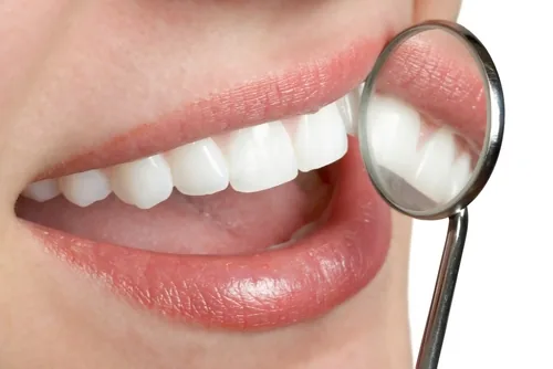 Smile Point Dental Oakville photo 4