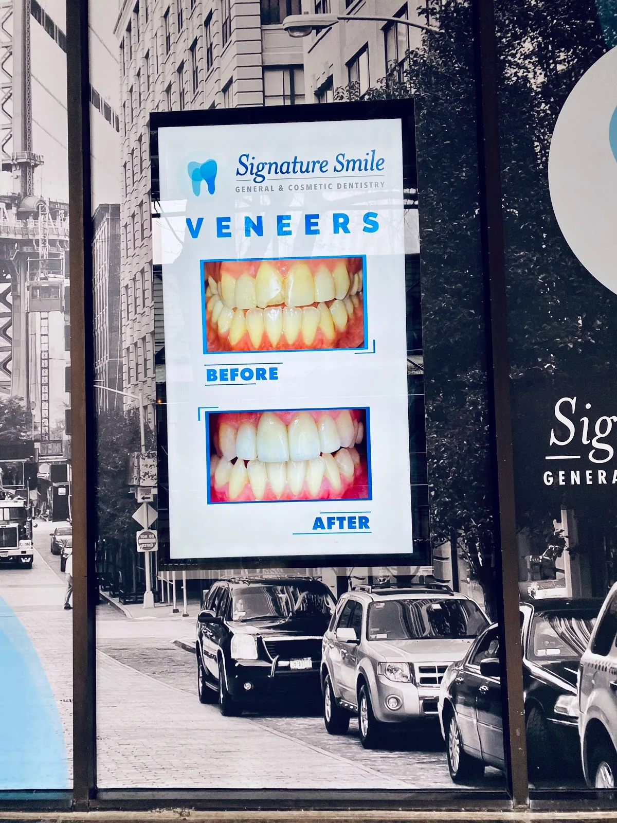 Signature Smile General & Cosmetic Dentistry - Brooklyn Heights photo 5