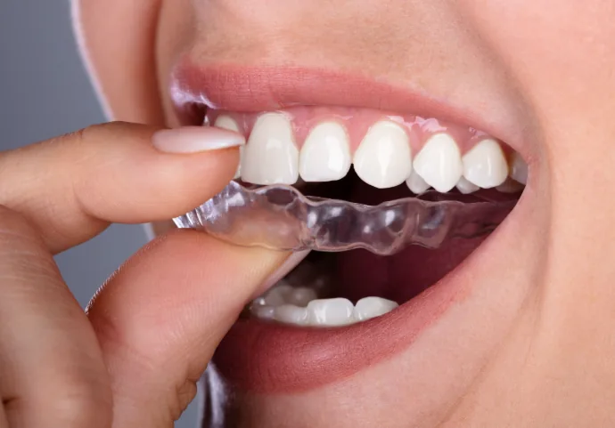 BH Dental NY- Brooklyn photo 3