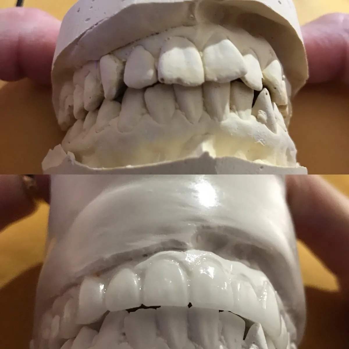 Central Valley Dentistry & Implants photo 4