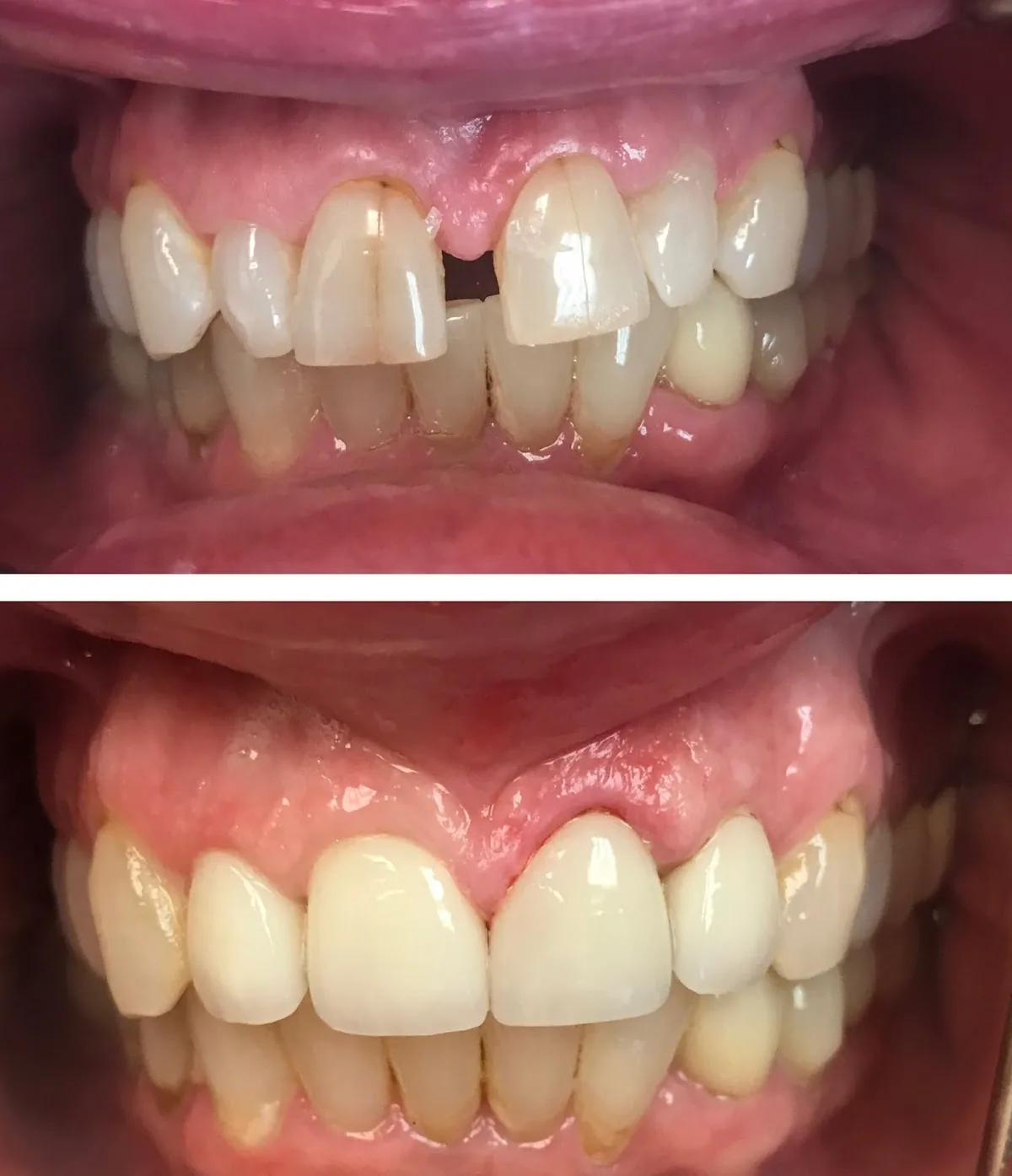 Central Valley Dentistry & Implants photo 2