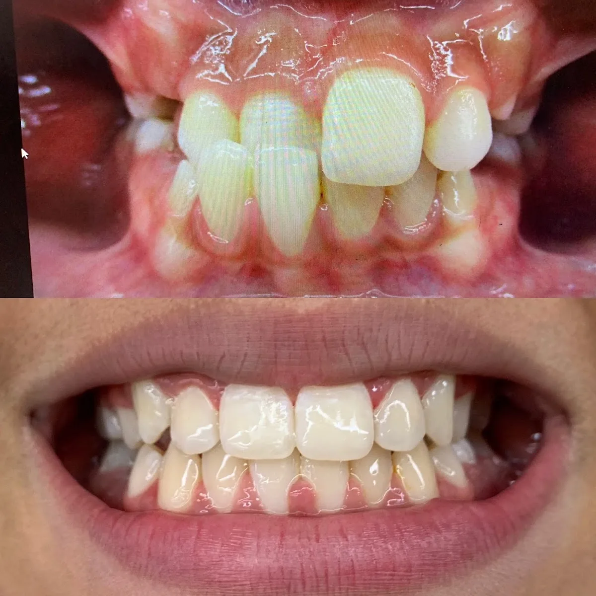 Smiley Face Braces Orlando photo 3