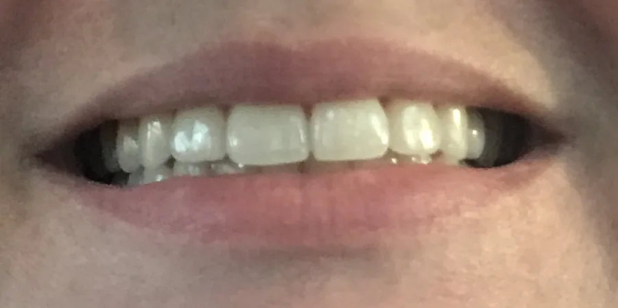 Marsh Orthodontics - William F Marsh DDS photo 3
