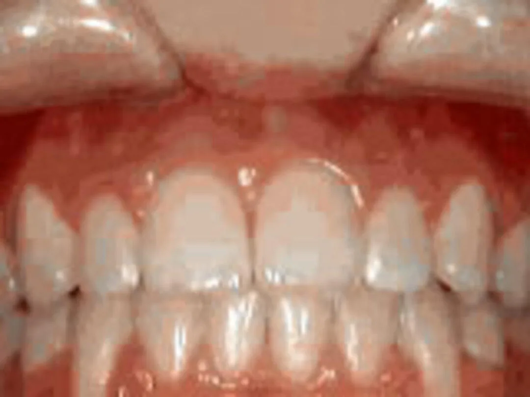 Marsh Orthodontics - William F Marsh DDS photo 1