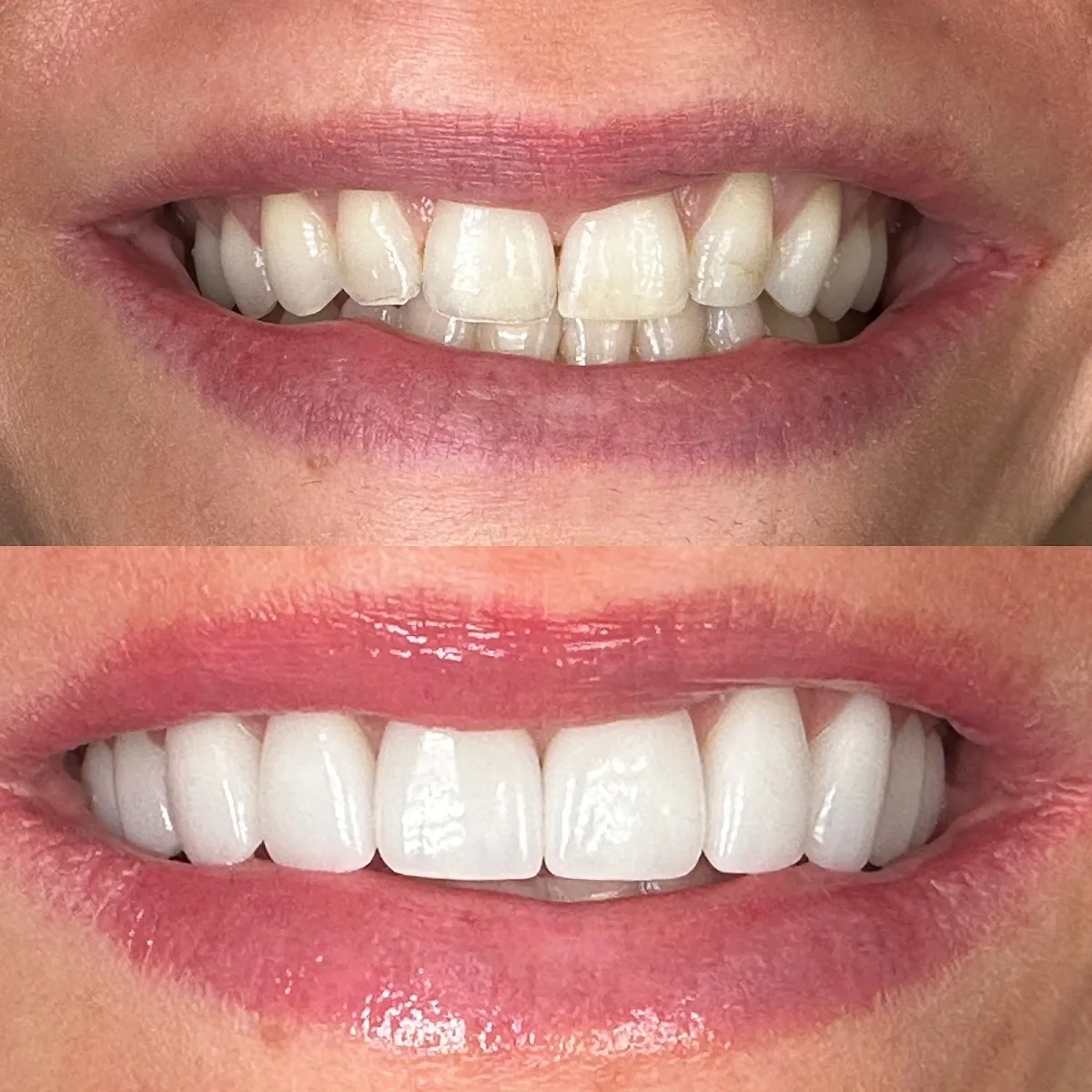 Centerport Cosmetic & Implant Dentistry
