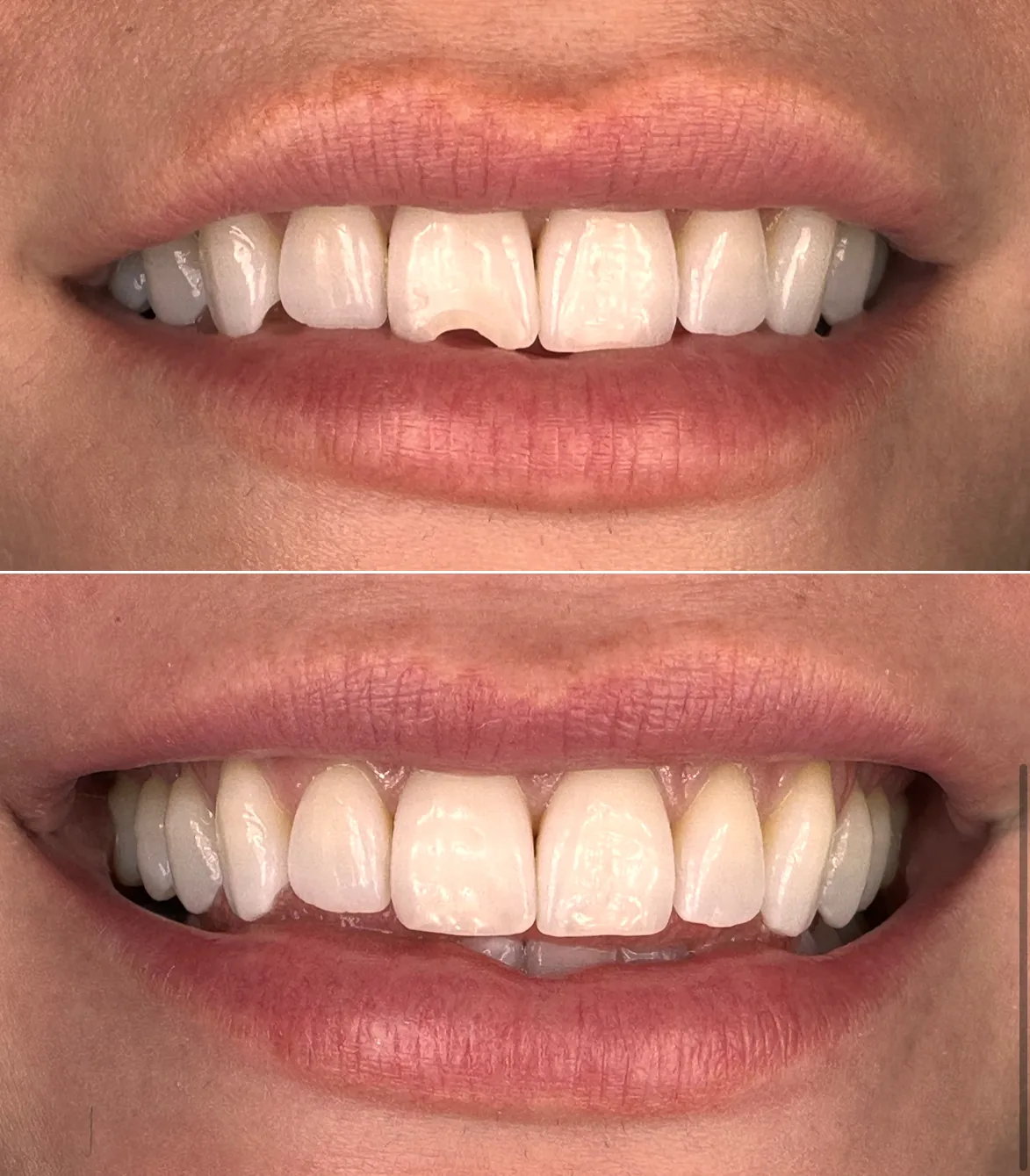 Centerport Cosmetic & Implant Dentistry photo 2