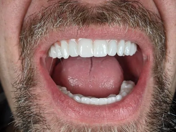 New Life Dental Implant Center photo 1