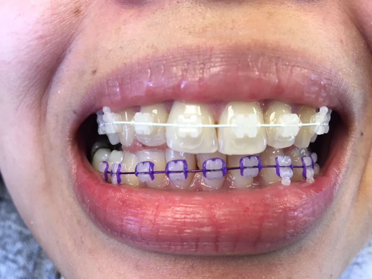 L.A. Dental Braces photo 2