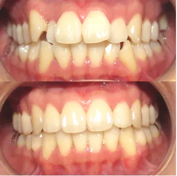 Embrace Orthodontics photo 2