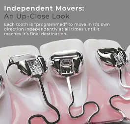 Embrace Orthodontics photo 1