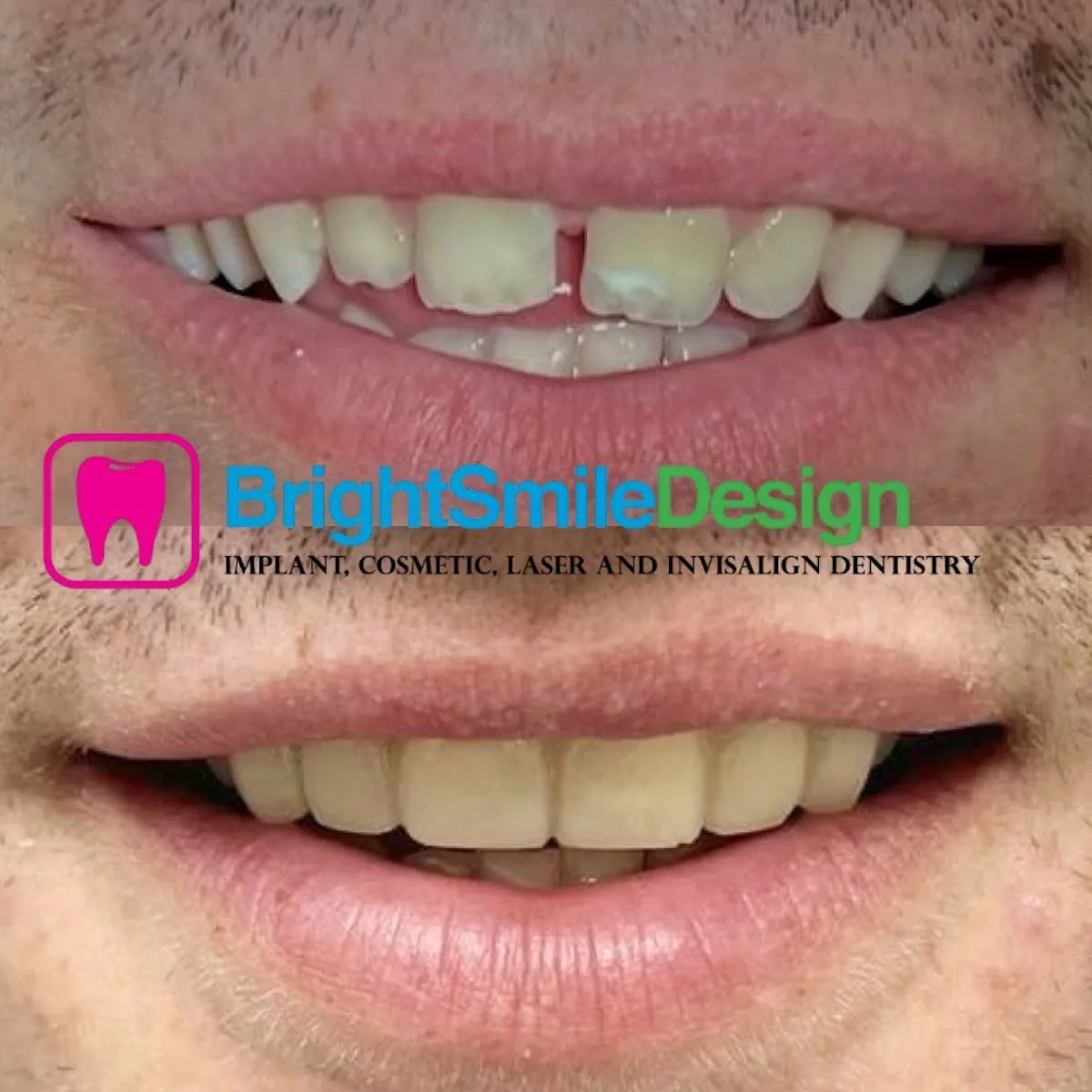 Bright Smile Design photo 2