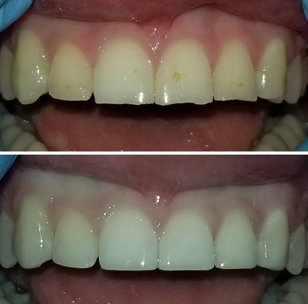 Melgosa Dental Turlock photo 3