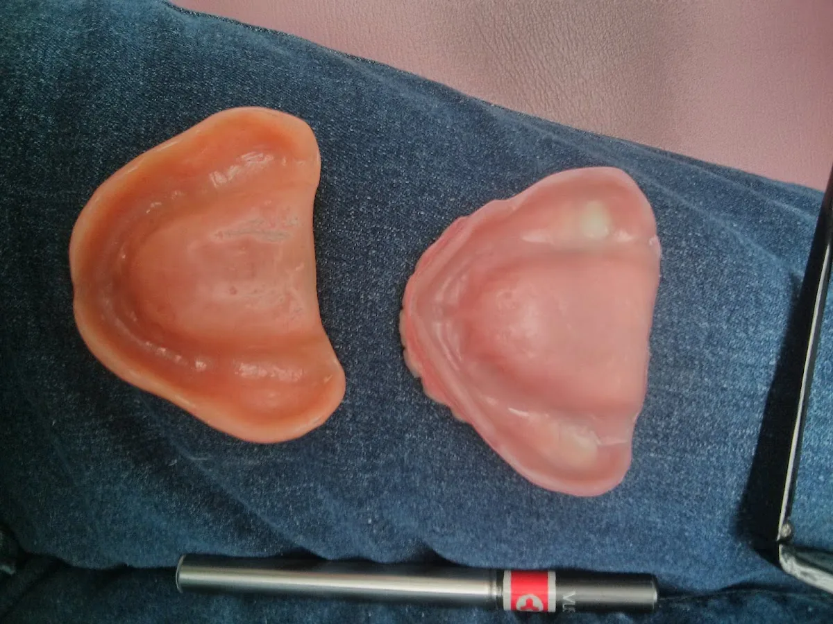 1 Day Denture photo 3