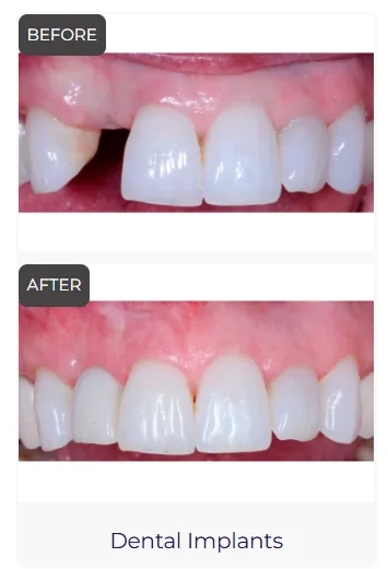 Precision Periodontics & Implantology - Tucson (Dr. Abhishek Patel) photo 3