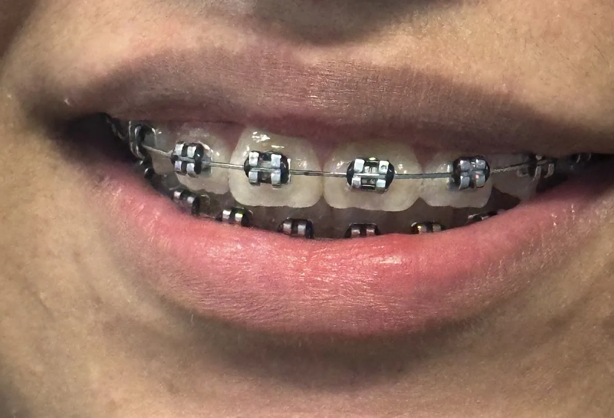 Gill Family Dentistry photo 2