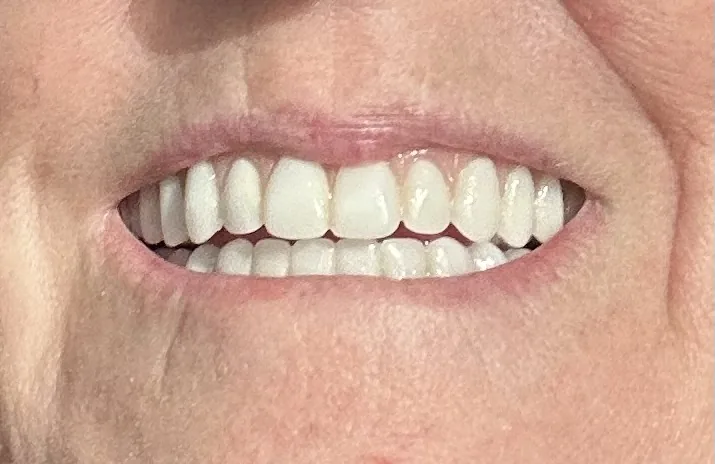 ClearChoice Dental Implant Center - San Antonio photo 2