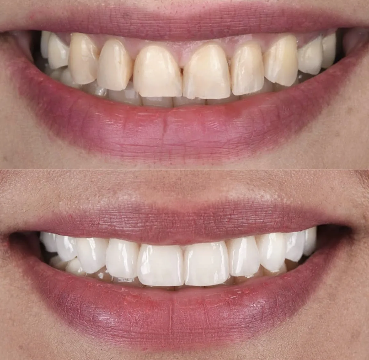 New Smiles Dental Implant Center Galleria photo 2