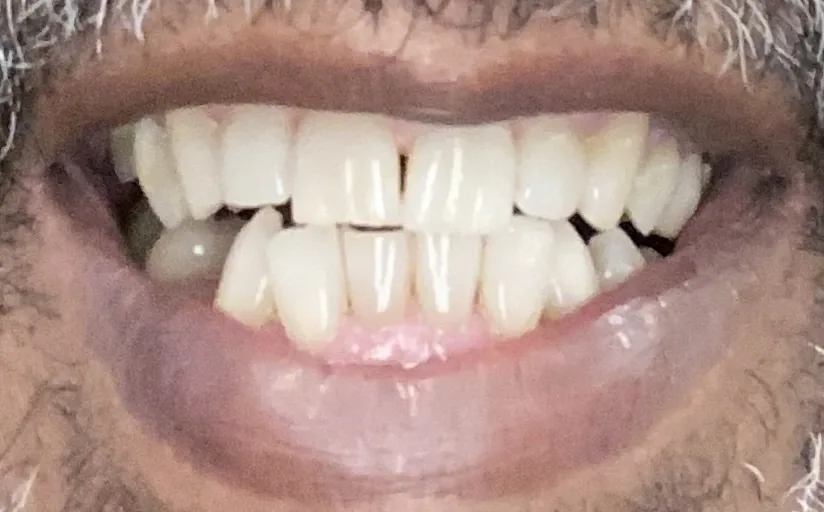 Eberhardt Dentistry: Kyle S. Eberhardt DDS photo 3