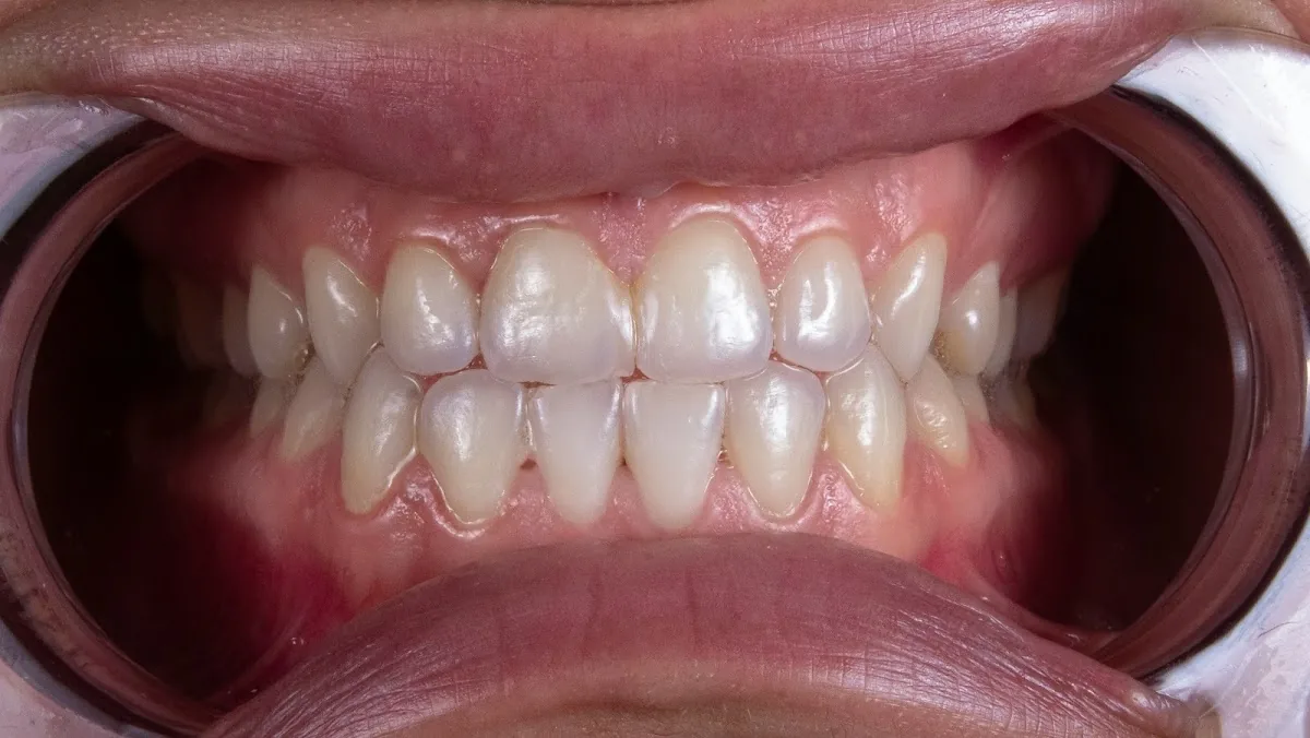 Elite Smile, LLC photo 2