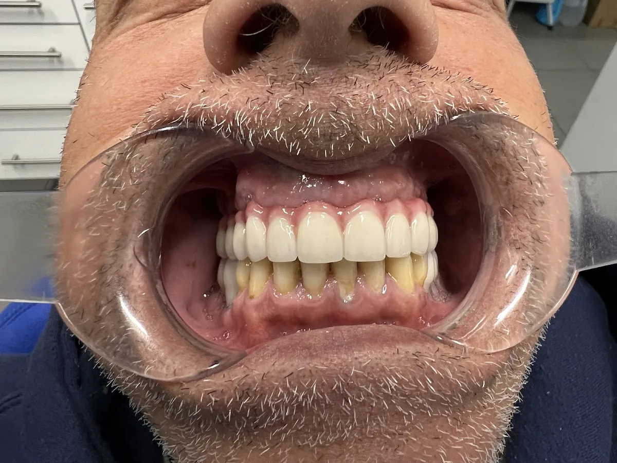 Louisiana Dental Implant Lab photo 2