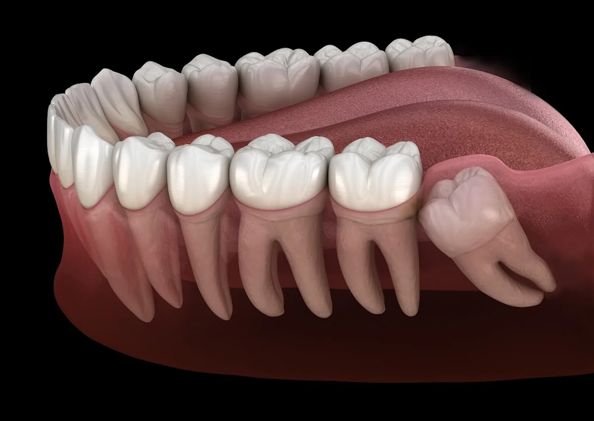 Valley Implants and Oral Surgery | Dr. Travis Sorensen D.D.S. photo 2