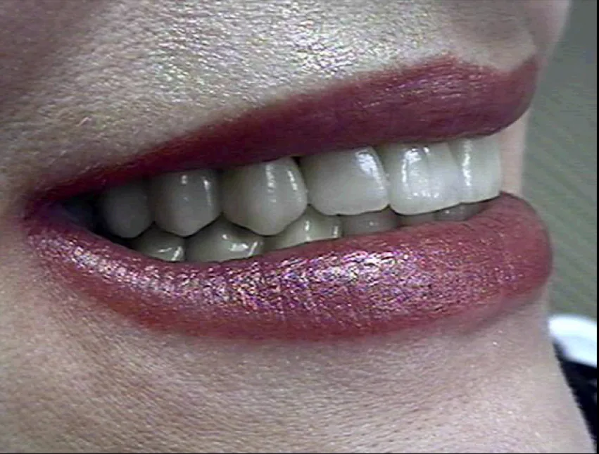 John G Masso DDS- Belcourt Family Dentistry PC photo 4