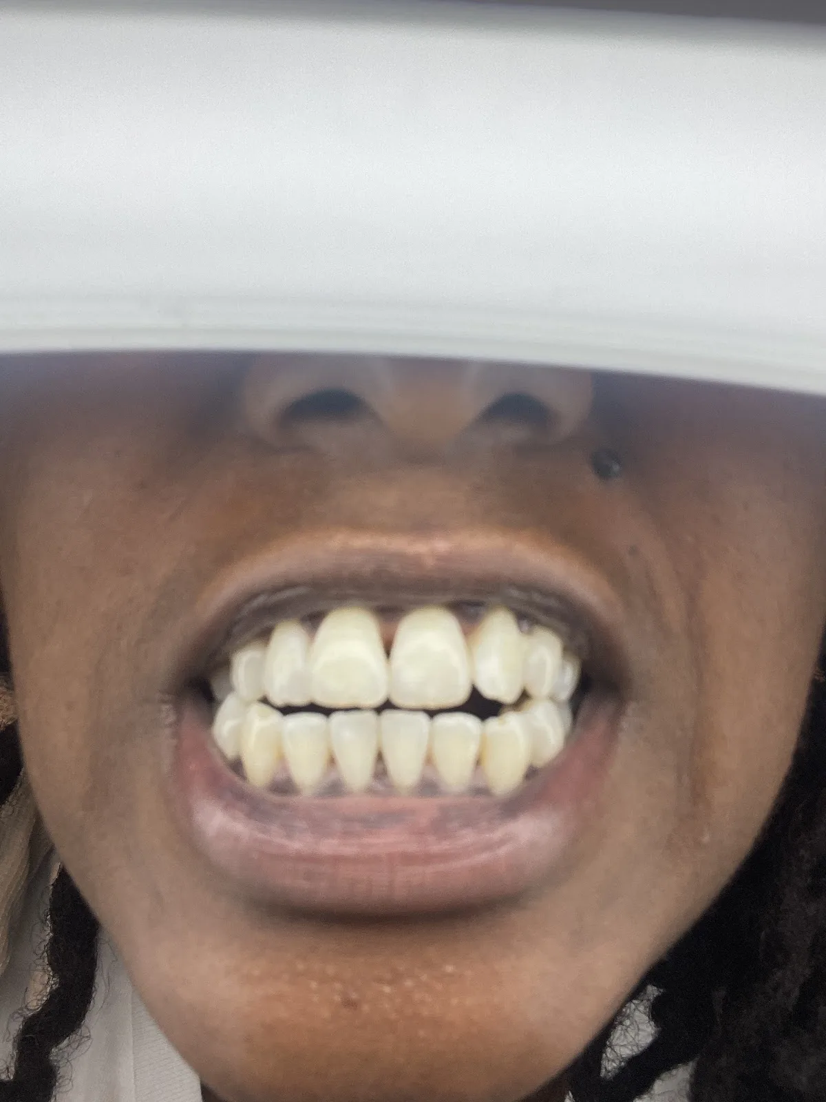 Dental Dreams - Belair photo 2
