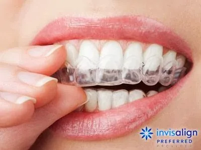 Davenport Village Dental photo 4