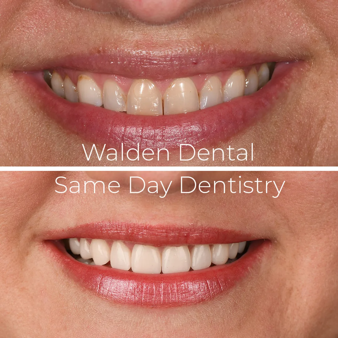 Walden Dental photo 3
