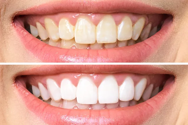 First Impressions Dentistry photo 3