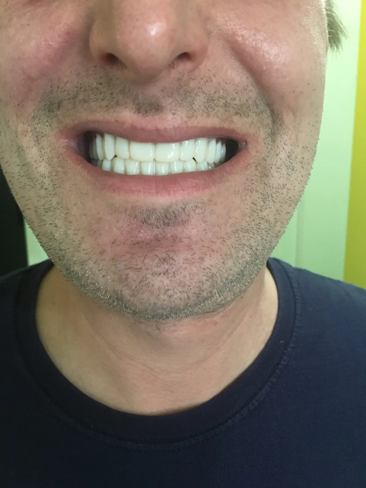 Aspen Dental photo 3
