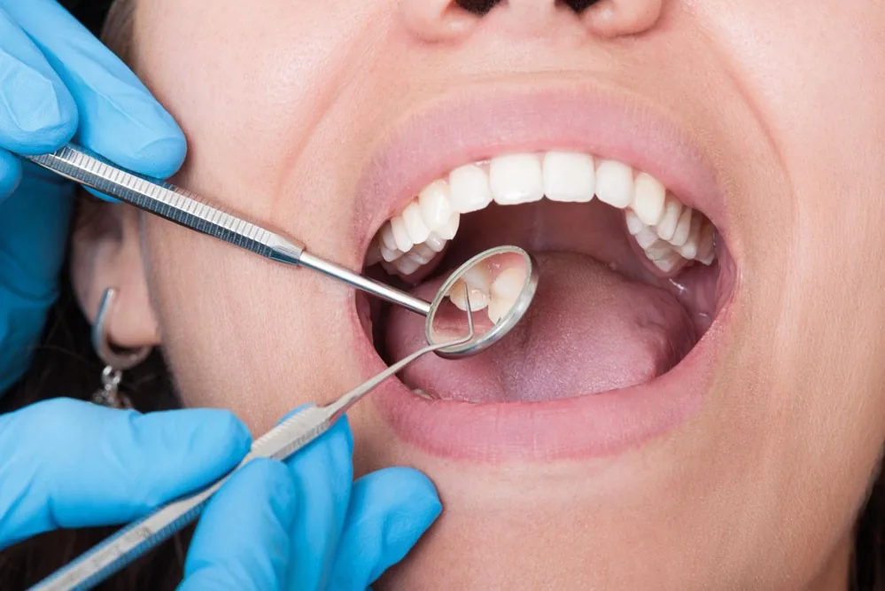 Nayar Dental Care Center photo 3