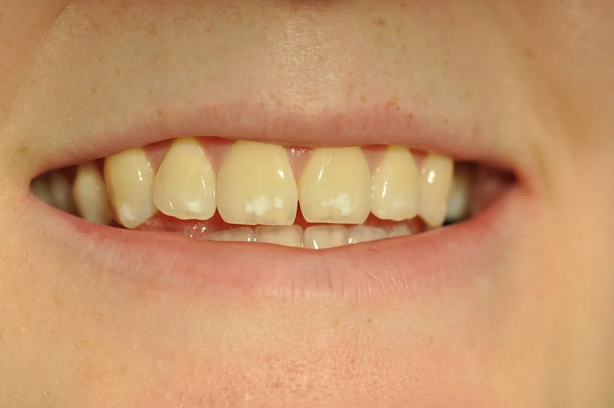 St. Owen Dental Studio Ltd photo 4