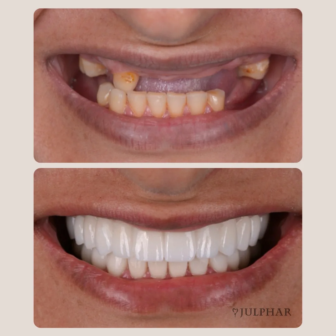 Julphar Implant & Cosmetic Dental Center - Julphar Tower Branch photo 3