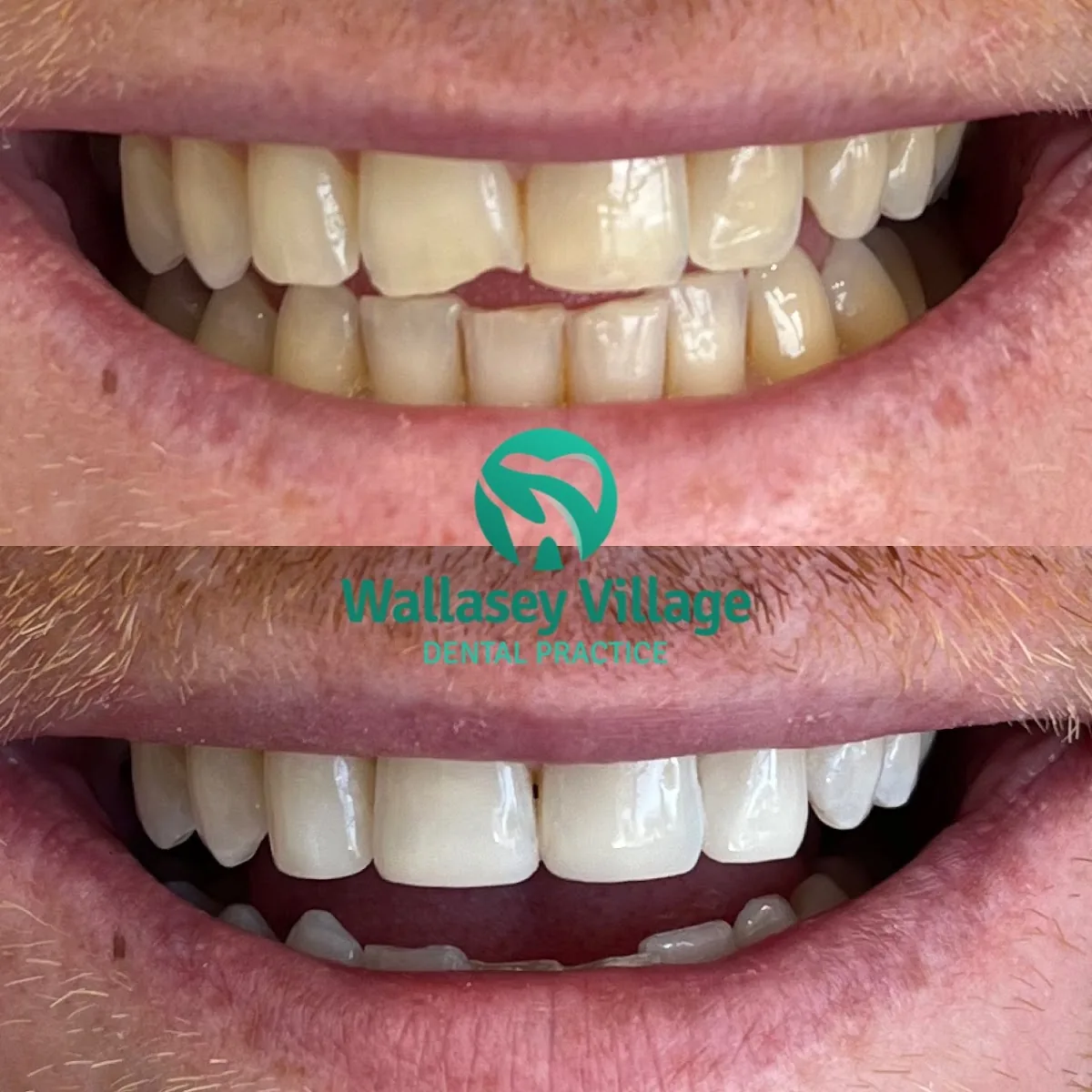 Wallasey Village Dental Practice photo 3