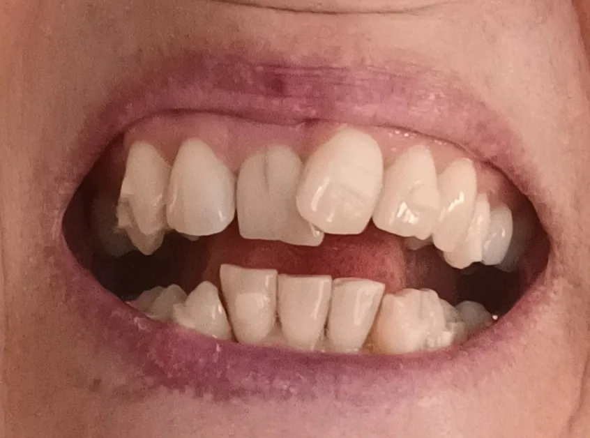 Bridge Dental & Implant Clinic photo 2