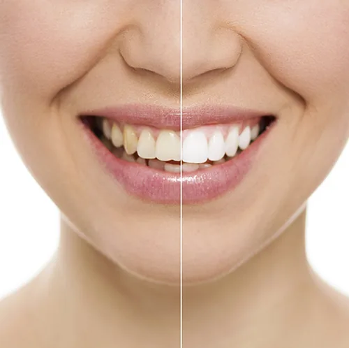 Densmile Dental Care photo 4
