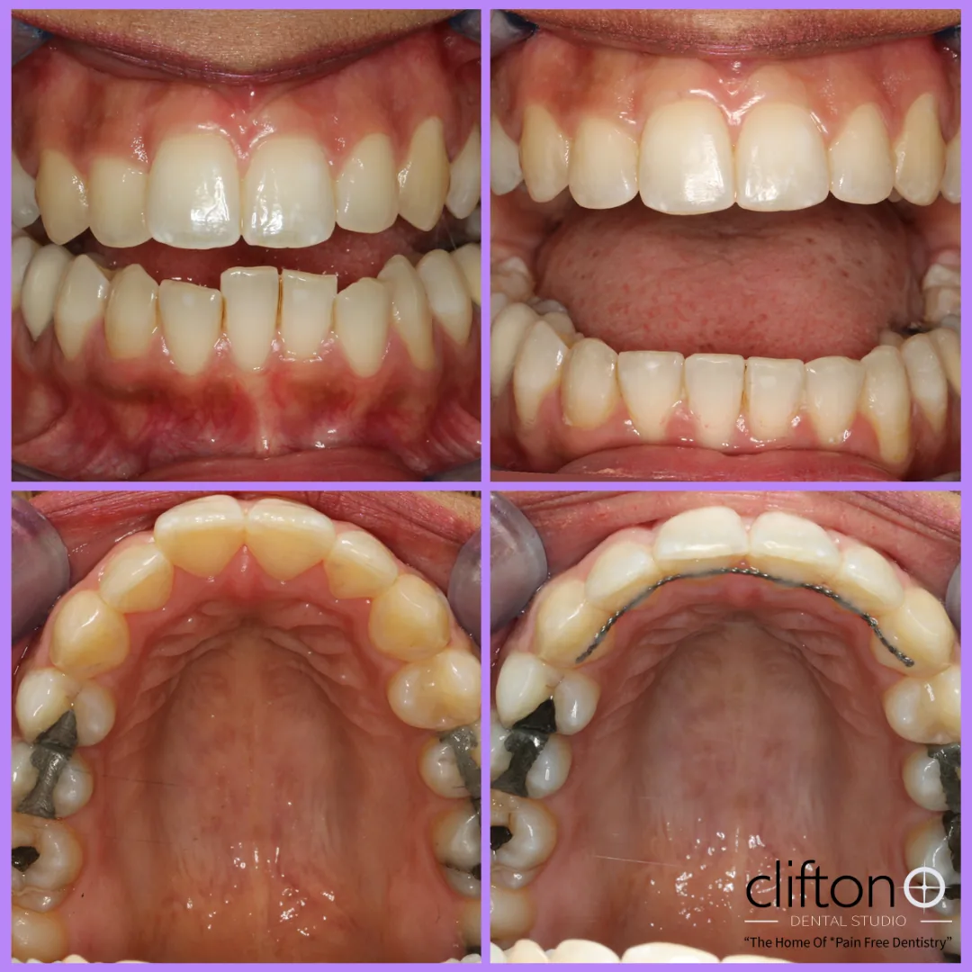 Clifton Dental Studio photo 3