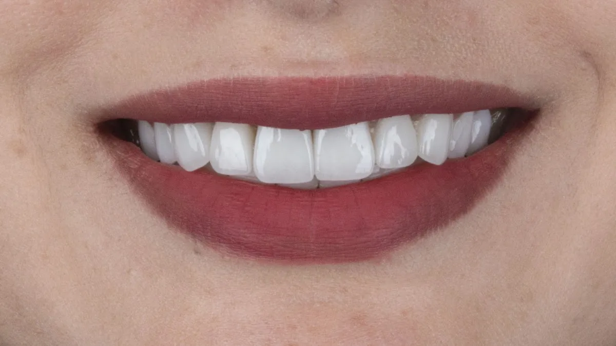 Amira Dental Clinic photo 4