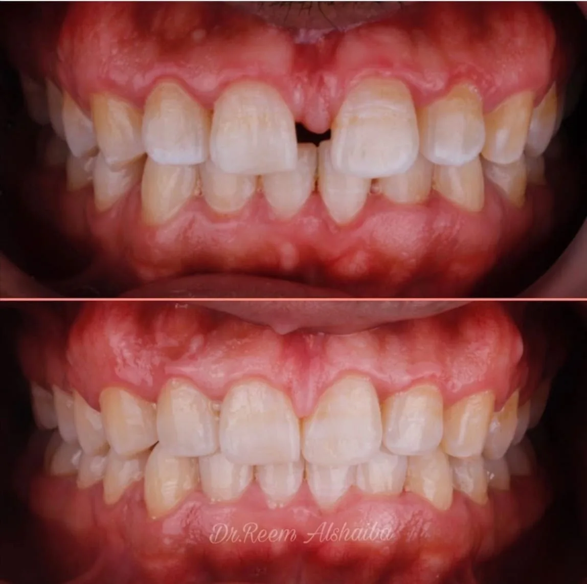 Aesthetica Dr Reem Al Shaiba Dental Center photo 2