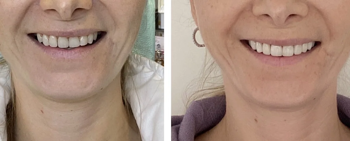 Dr. Denys Kovalchuk, DDS photo 4