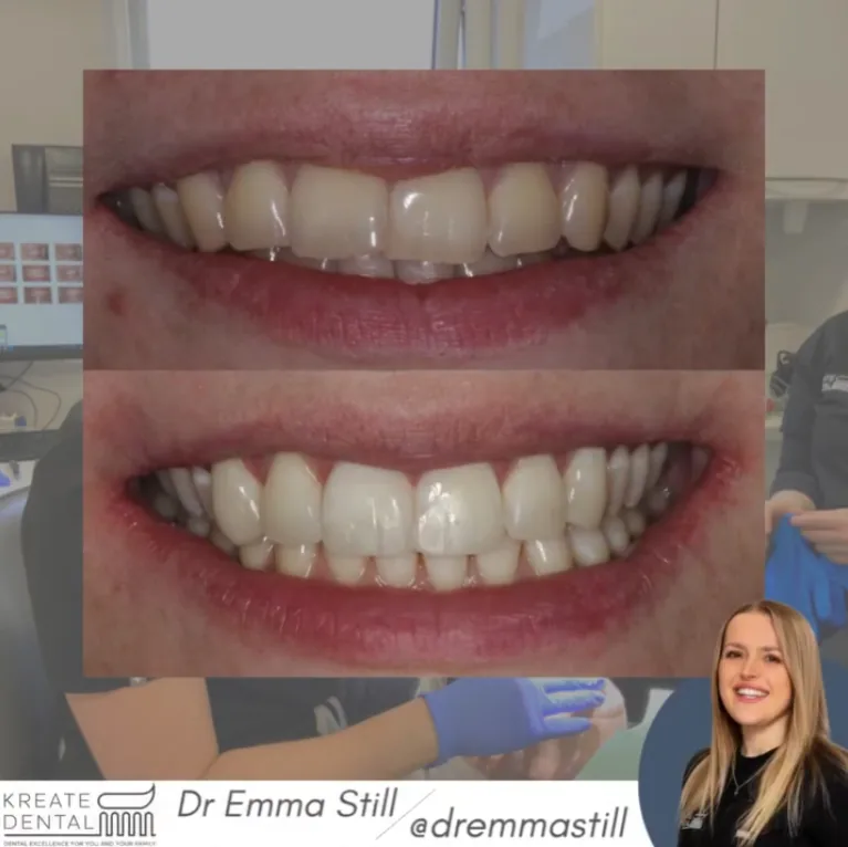 Kreate Dental photo 3