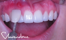 NewSmile Dentalcare Woodhouse Lane