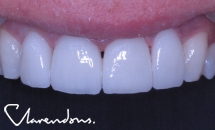 NewSmile Dentalcare Woodhouse Lane