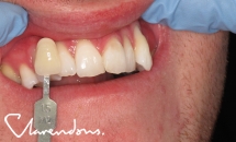 Clarendon Dental Spa