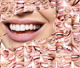 Marmaris Dental Clinic Turkey