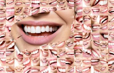 Marmaris Dental Clinic Turkey