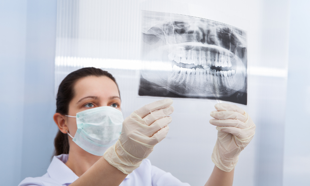 Dental XRay Post Picture